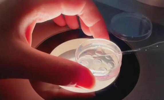 在宜昌做试管生孩子要多少钱！宜昌中心医院试管婴儿费用