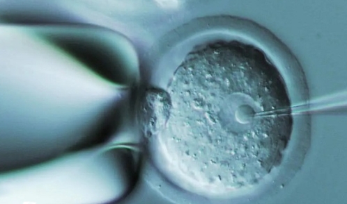 做试管婴儿能报销医保吗？助孕费用